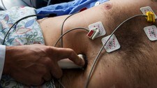 EKG og Ultralyd av hjerte (Foto: Kallestad, Gorm/NTB scanpix)
