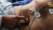 EKG og Ultralyd av hjerte (Foto: Kallestad, Gorm/NTB scanpix) EKG og Ultralyd av hjerte (Foto: Kallestad, Gorm/NTB scanpix)