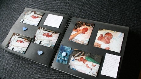 Albumet med babybilder er mye verdt for hele familien (Foto: Espen Hatlestad) Albumet med babybilder er mye verdt for hele familien (Foto: Espen Hatlestad)