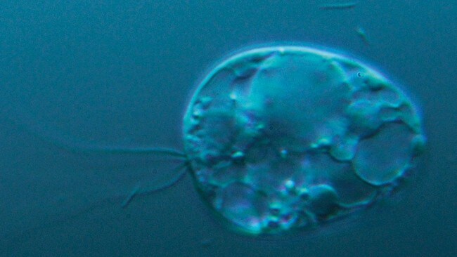 Collodictyon (Foto: UiO/ Yngve Vogt) Collodictyon (Foto: UiO/ Yngve Vogt)