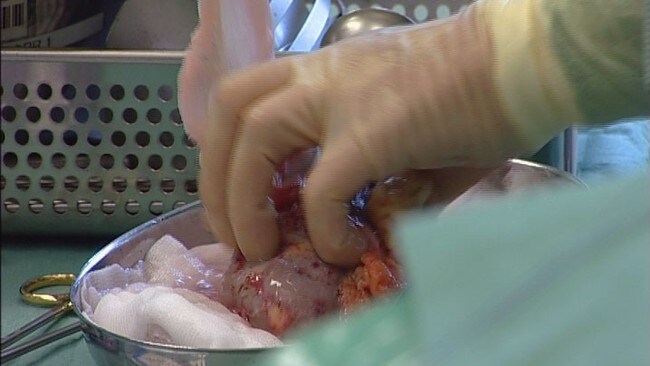 Organdonasjon (Foto: Anders Leines/NRK) Organdonasjon (Foto: Anders Leines/NRK)