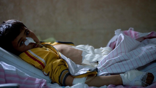 Såret gutt i Idlib i Syria (Foto: Rodrigo Abd/Ap) Såret gutt i Idlib i Syria (Foto: Rodrigo Abd/Ap)