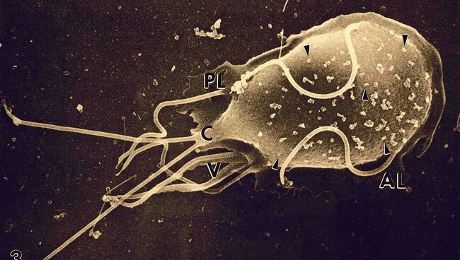 Giardia-parasitten (Foto: AP Photo/News Ltd/AP) Giardia-parasitten (Foto: AP Photo/News Ltd/AP)