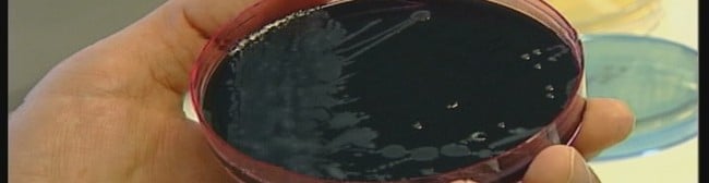 Legionella-bakterien (NRK) Legionella-bakterien (NRK)
