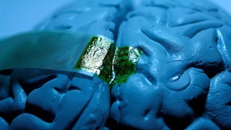 BRAIN-IMPLANT/ (Foto: HO/Reuters) BRAIN-IMPLANT/ (Foto: HO/Reuters)