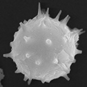 Crysophyte cyste (Foto: Catherine Stickley/Nalan Koc, Norsk Polarinstitutt) Crysophyte cyste (Foto: Catherine Stickley/Nalan Koc, Norsk Polarinstitutt)