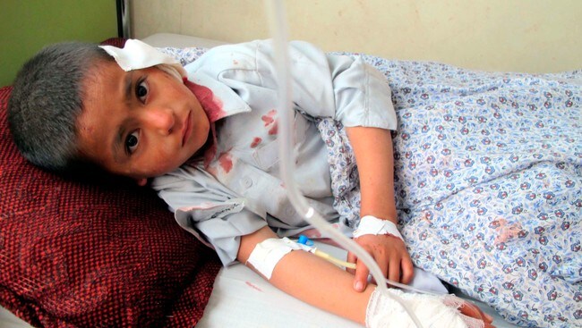 En såret afghansk gutt på sykehussengen (Foto: STRINGER/AFGHANISTAN/Reuters) En såret afghansk gutt på sykehussengen (Foto: STRINGER/AFGHANISTAN/Reuters)