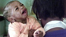 HIV-smittet barn i Afrika (Foto: DENIS FARRELL/AP) HIV-smittet barn i Afrika (Foto: DENIS FARRELL/AP)
