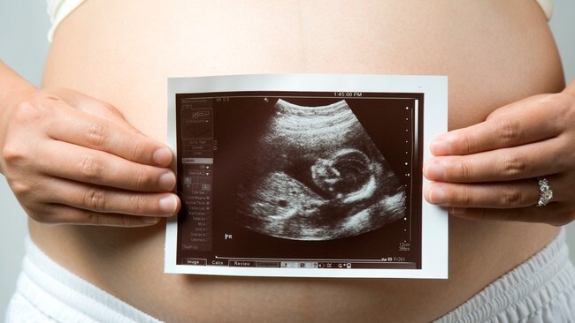 Gtavid dame med ultralydbilde (ScanStock Photo) Gtavid dame med ultralydbilde (ScanStock Photo)