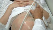 Video Aborterte fostre levde videre i en time (Foto: Nyhetsspiller)