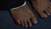 David Haye bokset med brukket tå - David haya bokset med brukket tå og kunne ikke fullføre slagene så godt som han ville.