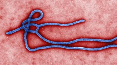 Ebola-viruset (Foto: Centers for Disease Control and Prevention/Wikimedia Commons) Ebola-viruset (Foto: Centers for Disease Control and Prevention/Wikimedia Commons)