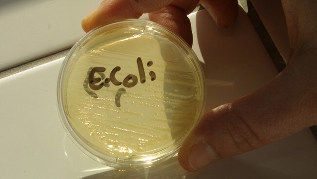E.coli bakterieprøve (Illustrasjonsfoto) (Foto: colourbox.no) E.coli bakterieprøve (Illustrasjonsfoto) (Foto: colourbox.no)