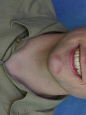 Johannes Bergh (Foto: Institutt for samfunnsforskning)