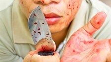 Kvinne med blodig kniv (Foto: Colourbox/Chainat Prachatree) Kvinne med blodig kniv (Foto: Colourbox/Chainat Prachatree)