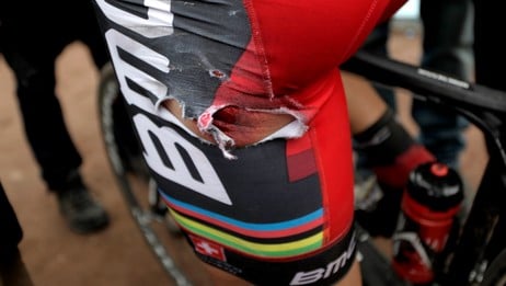 Thor Hushovd fikk kjøttsår (Foto: Lauten, Daniel Sannum/Scanpix) Thor Hushovd fikk kjøttsår (Foto: Lauten, Daniel Sannum/Scanpix)