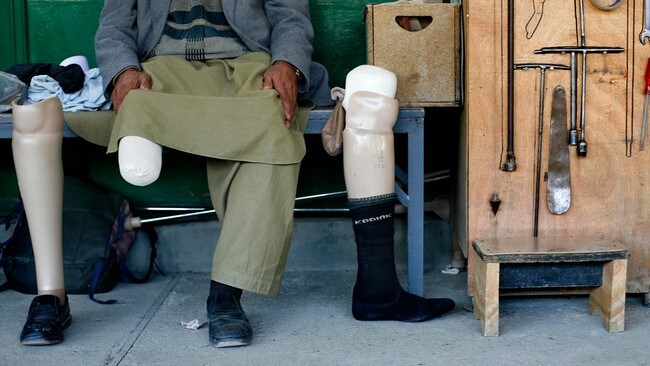 Afghansk offer for landmine (Foto: Jerry Lampen /Scanpix/Reuters) Afghansk offer for landmine (Foto: Jerry Lampen /Scanpix/Reuters)