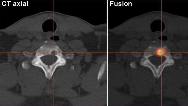 CT- og PET-scan (Foto: Wikimedia Commons) CT- og PET-scan (Foto: Wikimedia Commons)