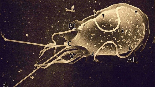 Giardia-parasitt (Scanpix/AP) Giardia-parasitt (Scanpix/AP)