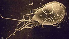 Giardia-parasitt (Scanpix/AP) Giardia-parasitt (Scanpix/AP)