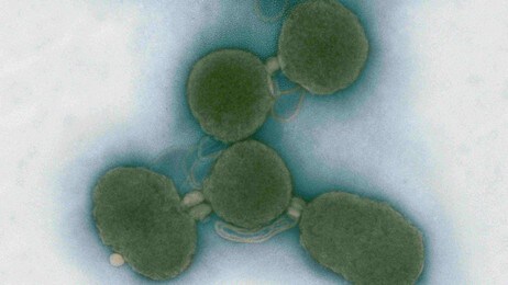 Synthetic Cell (AP) Synthetic Cell (AP)