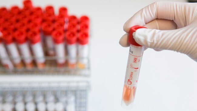 Mikrobiologisk laboratorium ved Ullevål Sykehus i Oslo får inn prøver og tester etter virus A (H1N1) (Foto: Roald, Berit/SCANPIX) Mikrobiologisk laboratorium ved Ullevål Sykehus i Oslo får inn prøver og tester etter virus A (H1N1) (Foto: Roald, Berit/SCANPIX)