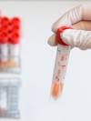 Mikrobiologisk laboratorium ved Ullevål Sykehus i Oslo får inn prøver og tester etter virus A (H1N1) (Foto: Roald, Berit/SCANPIX)