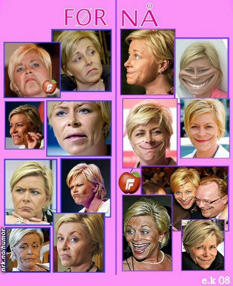 Siv Jensen - før og nå (Foto: Fotofikling: Elin Kristiansen) Siv Jensen - før og nå (Foto: Fotofikling: Elin Kristiansen)