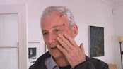 Trevor viser skadane han meiner politiet gav han - Trevor Jonathan Caine (65) hevdar han vart slått medvitslaus av to UP-tenestemenn.