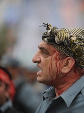 Skadd afghansk politimann etter opptøyer i Kabul (Foto: Yuri Cortez/AFP) Skadd afghansk politimann etter opptøyer i Kabul (Foto: Yuri Cortez/AFP)