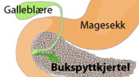 Bukspyttkjertel (Foto: Illustrasjon: Wikipedia) Bukspyttkjertel (Foto: Illustrasjon: Wikipedia)