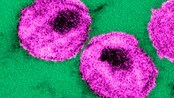 Hiv-virus (Scanpix) Hiv-virus (Scanpix)