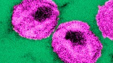 Hiv-virus (Scanpix) Hiv-virus (Scanpix)
