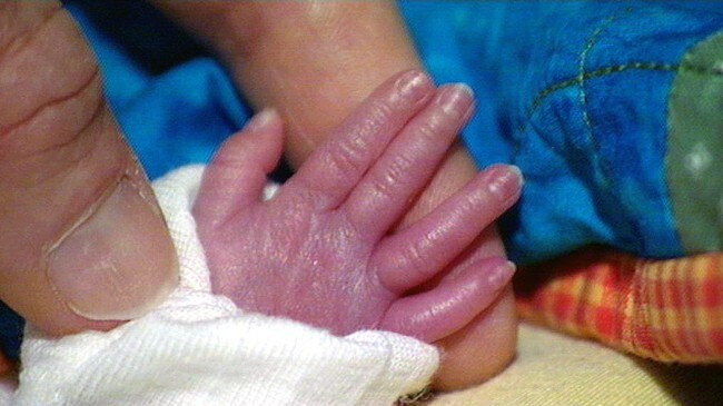 Babyhand (Foto: Anette Berentsen/NRK)