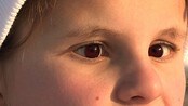 Noras øyne Megafon - Nora skal gå skirenn, men hvordan går det når man nesten er blind?