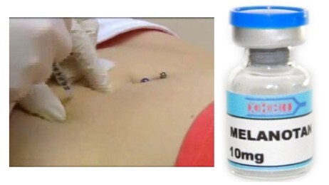 Melanotan Melanotan