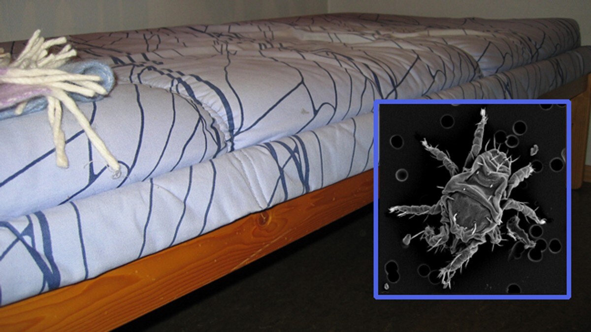 Nå kan du drepe madrassmidden NRK Livsstil