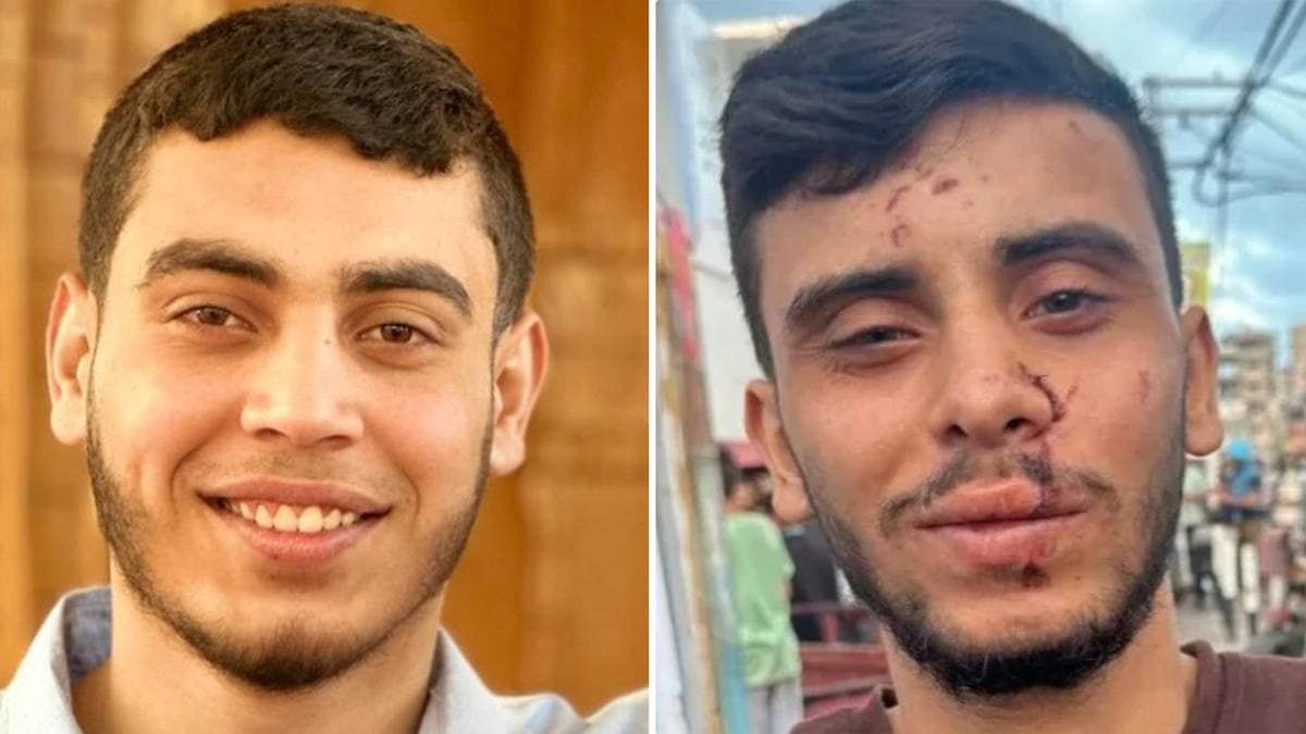 Mohammed (19) har opphaldsløyve i Noreg – men får ingen hjelp til å forlate Gaza