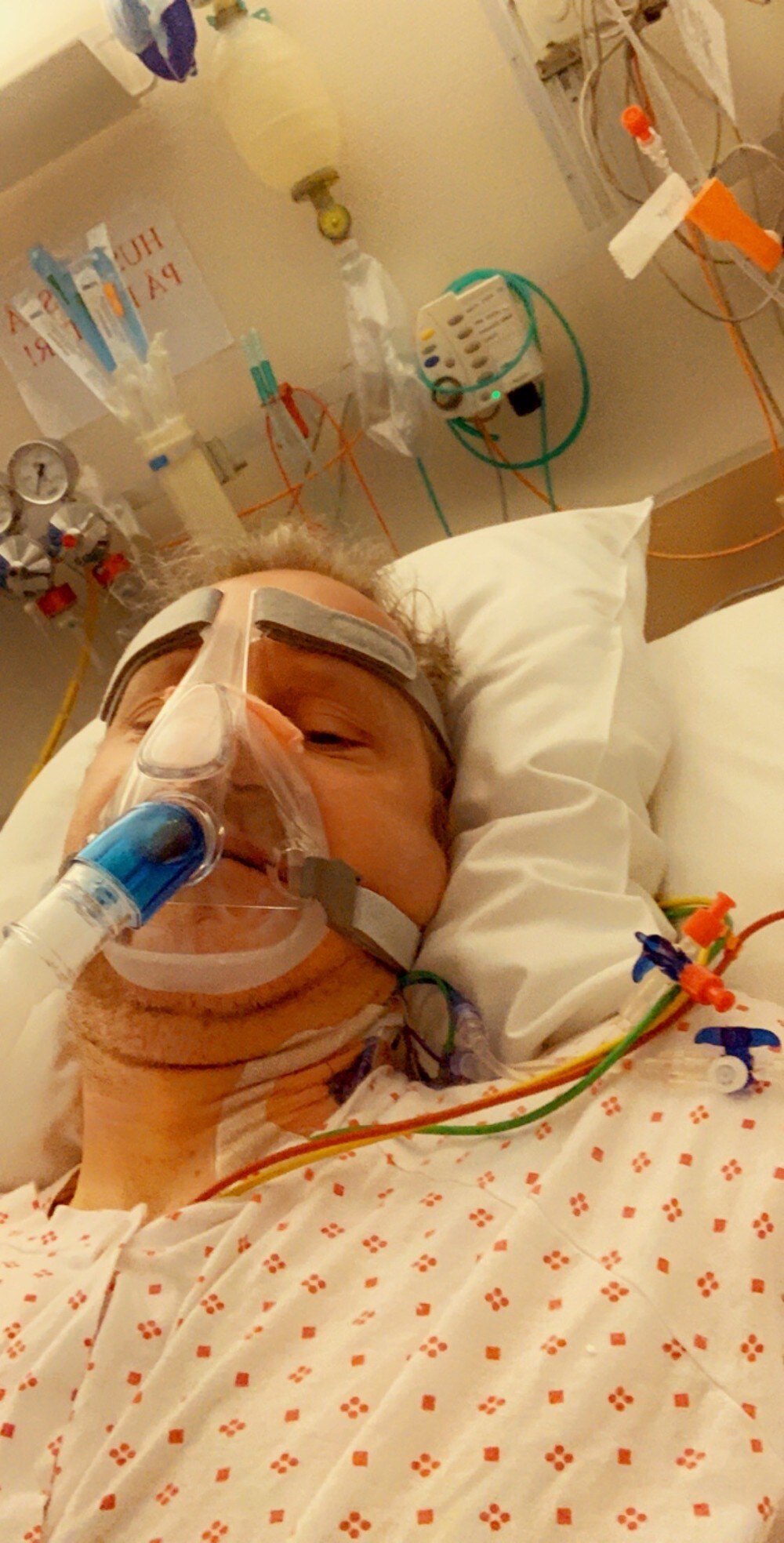 Ørjan (46) fikk påvist korona – lå fire dager i pustemaskin med akutt lungesvikt