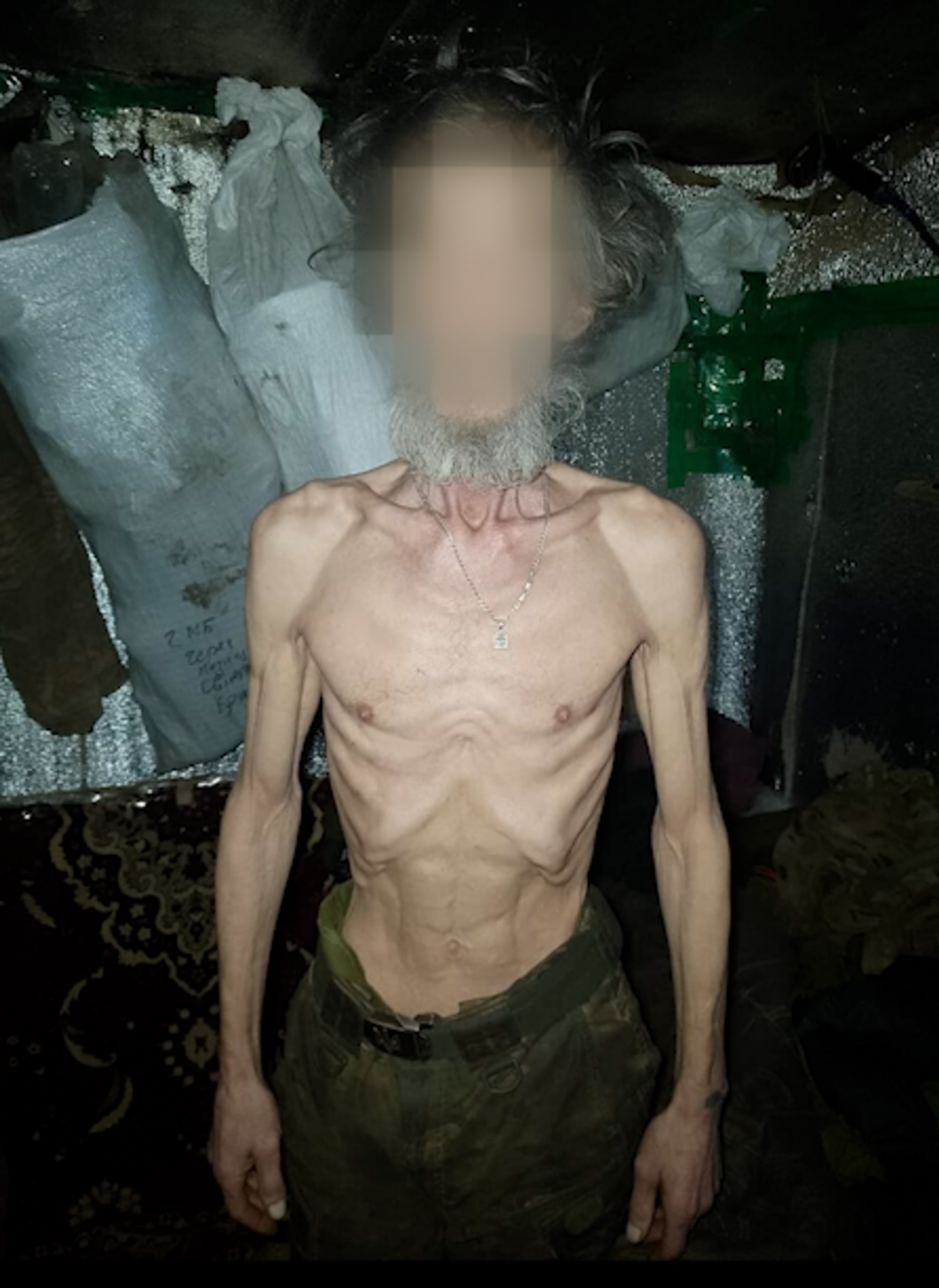 En svært avmagret mann står i det som ser ut til å være et rom med lite lys og mye rot. Mannen har på seg en militærinspirert bukse. Bakgrunnen er ujevn og dekket av et grått, glinsende materiale. Til venstre henger en stor hvit pose med tekst på. (Bildebeskrivelsen er laget av en KI-tjeneste)