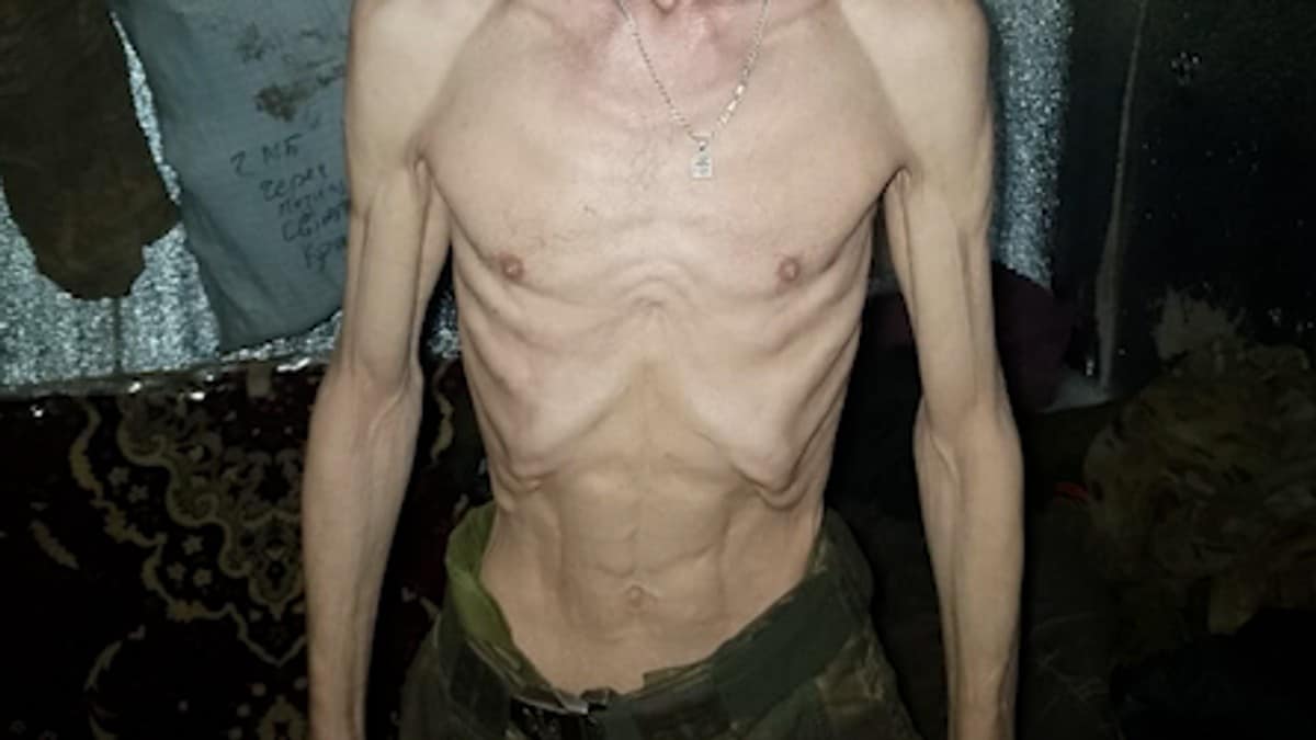 Ukrainske soldater fikk ikke levert mat: &ndash; Mister bevisstheten