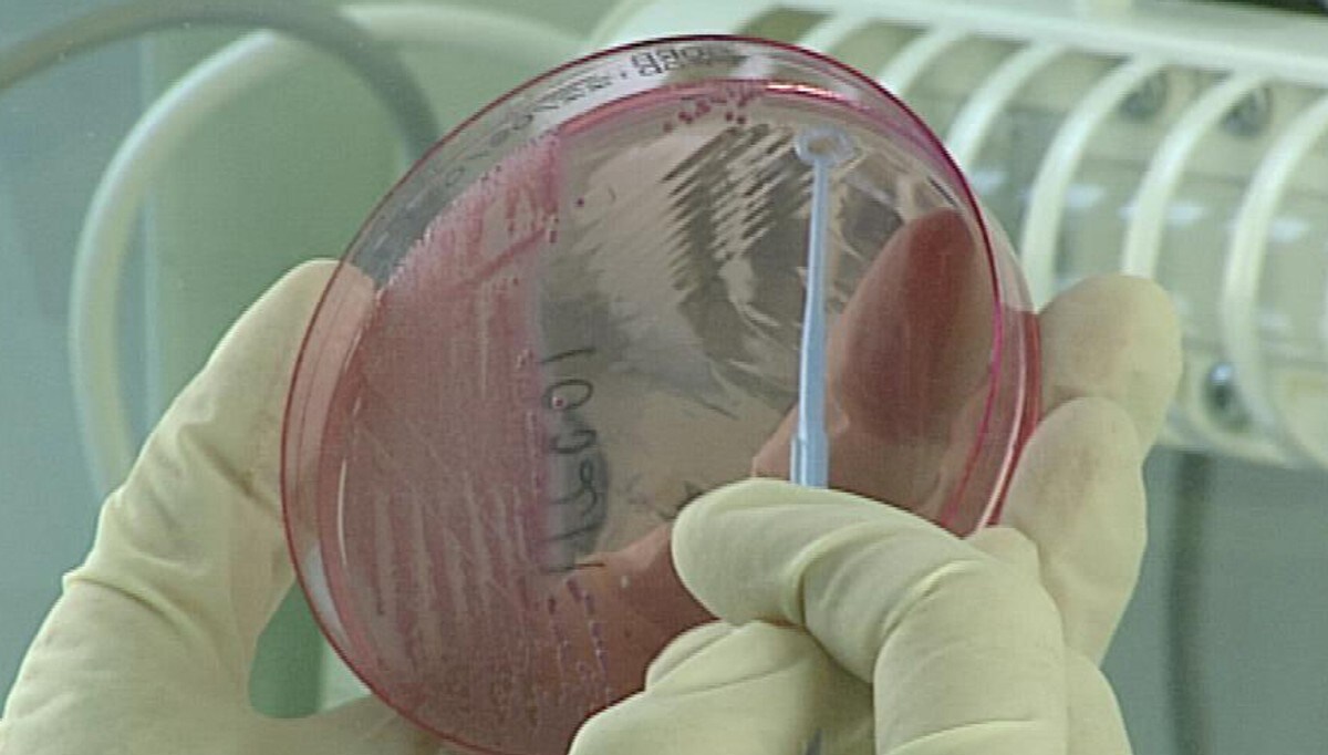 FHI etter E.coli-utbrot: – Barn kan få akutt nyreskade