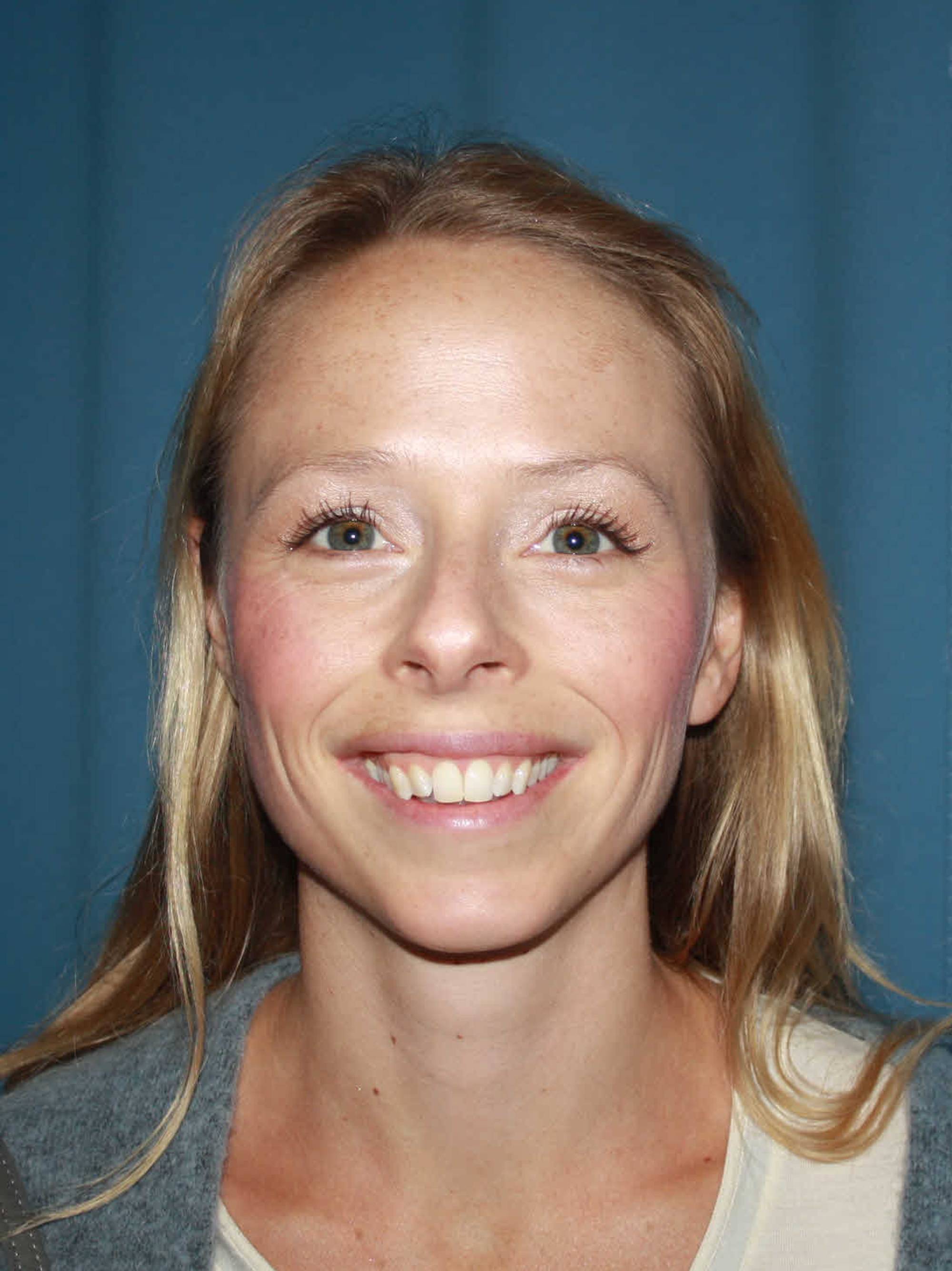 Kvinne med blondt hår