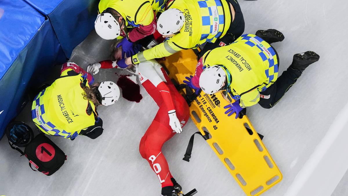 Skrekkulykke i OL – fikk skøyte mot øyet