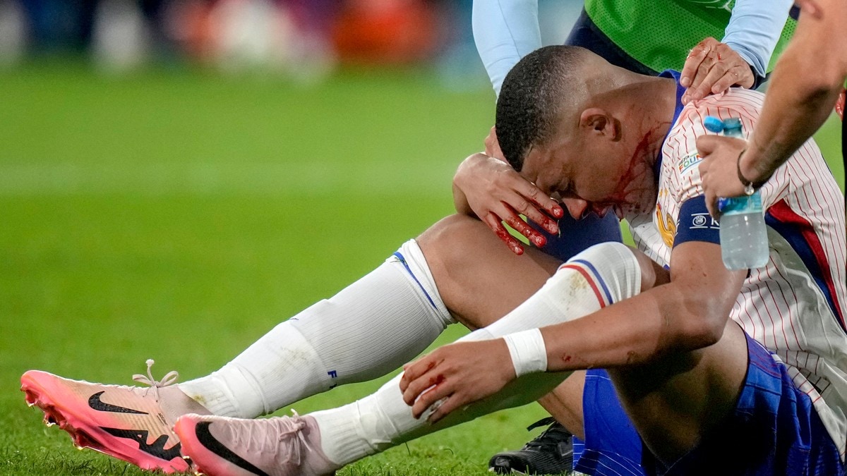 Franske medier: Kylian Mbappé mister nøkkelkampen mot Nederland i fotball-EM