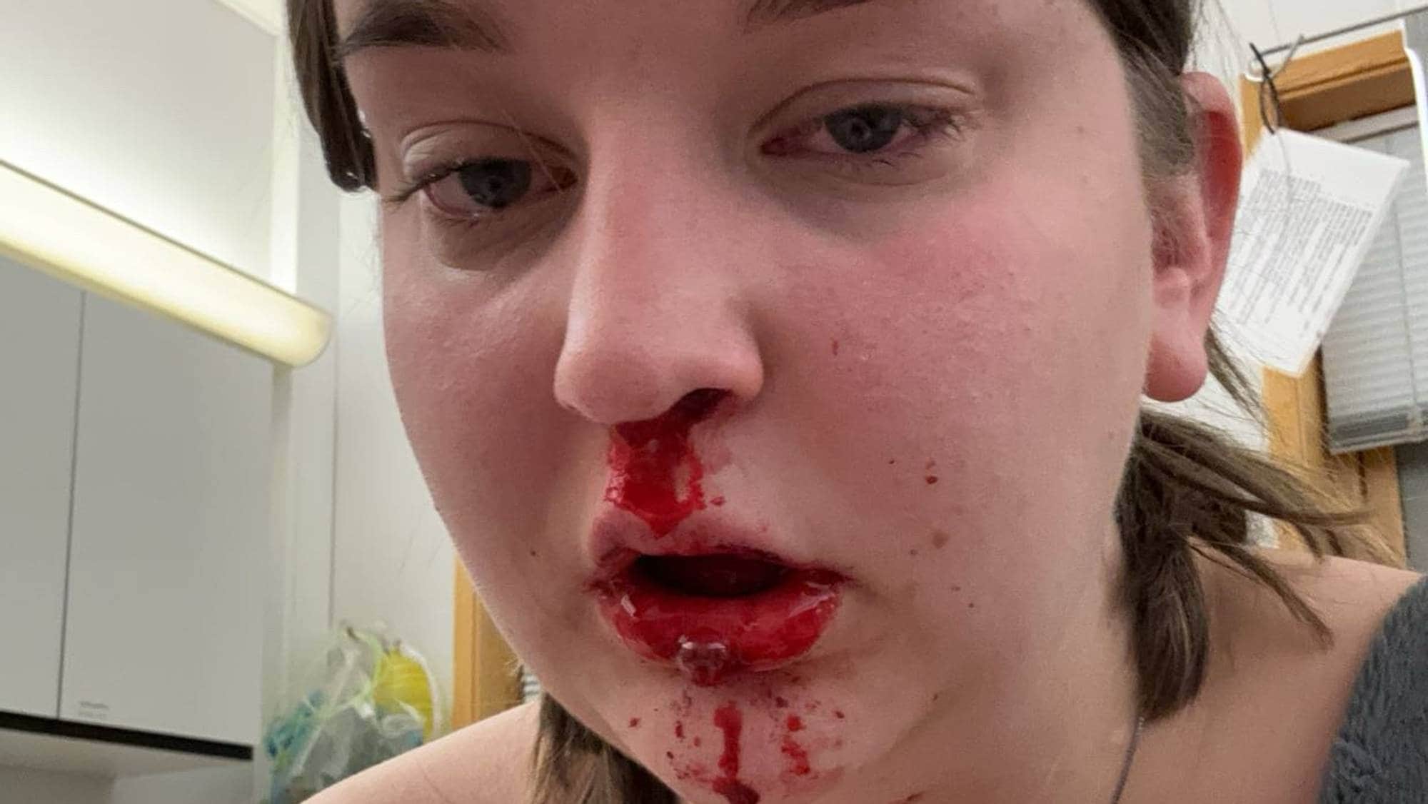 Ida Leirbakken på legevakt i Alta på grunn av blødning i halsen. 