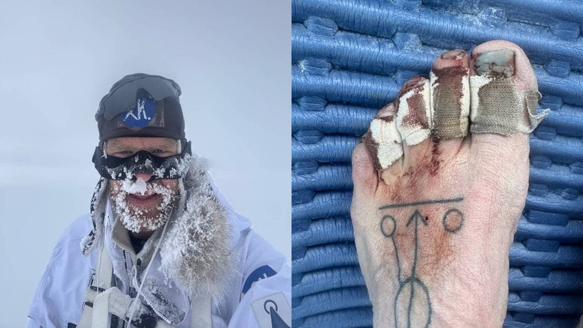 Ville bli verdas raskaste til Sydpolen: – Fekk dei styggaste beina