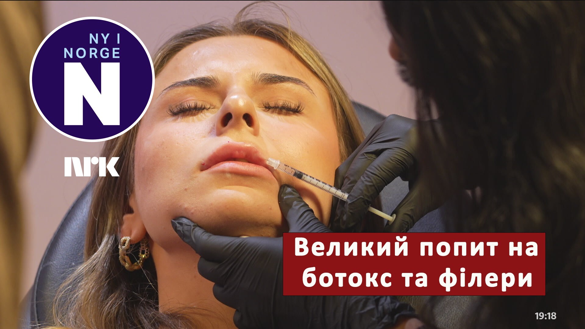 Stor etterspørsel etter Botox og fillers 30.11.2025 – Norwegian news in ...