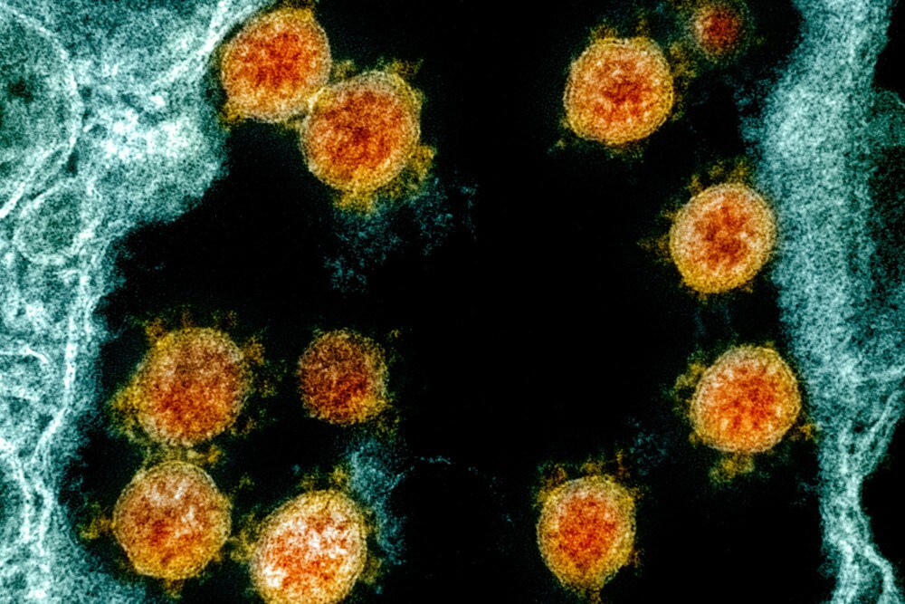 Ny studie: Korona-syke blir immune i minst seks måneder