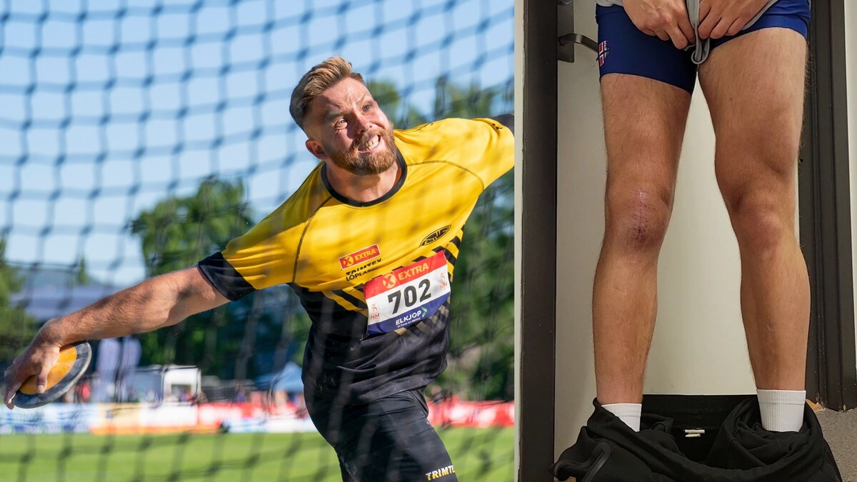 NM-vinnerens muskler visnet bort – måtte skru fast kneskålen etter marerittskade